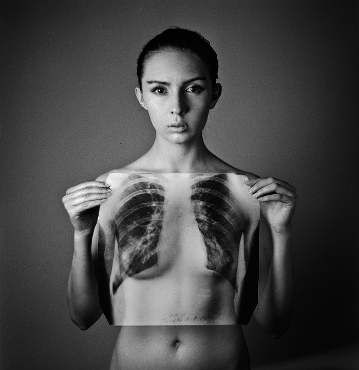 Фотографія x-ray / Андрей Коротич / photographers.ua